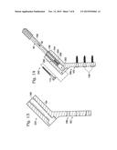 HIP FIXATION WITH LOAD-CONTROLLED DYNAMIZATION diagram and image