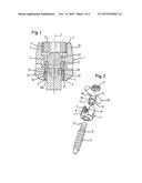 BONE ANCHORING DEVICE diagram and image