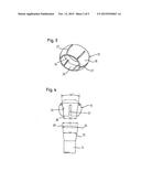 BONE ANCHORING DEVICE diagram and image