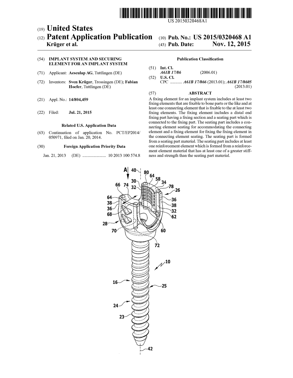 IMPLANT SYSTEM AND SECURING ELEMENT FOR AN IMPLANT SYSTEM - diagram, schematic, and image 01