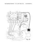 ELECTROSURGICAL GENERATOR diagram and image