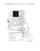 ELECTROSURGICAL GENERATOR diagram and image