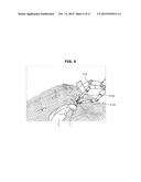 SURGICAL ROBOTS AND CONTROL METHODS THEREOF diagram and image