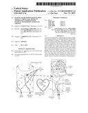 SYSTEM AND METHODS FOR USING BODY SURFACE CARDIAC ELECTROGRAM INFORMATION     COMBINED WITH INTERNAL INFORMATION TO DELIVER THERAPY diagram and image