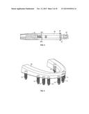 COMPONENTS FOR USE WITH A SURGICAL GUIDE FOR DENTAL IMPLANT PLACEMENT diagram and image