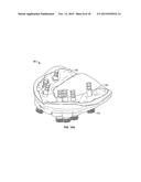 COMPONENTS FOR USE WITH A SURGICAL GUIDE FOR DENTAL IMPLANT PLACEMENT diagram and image