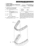 ORTHODONTIC TOOTH MOVEMENT DEVICE, SYSTEMS AND METHODS diagram and image