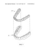 ORTHODONTIC TOOTH MOVEMENT DEVICE, SYSTEMS AND METHODS diagram and image