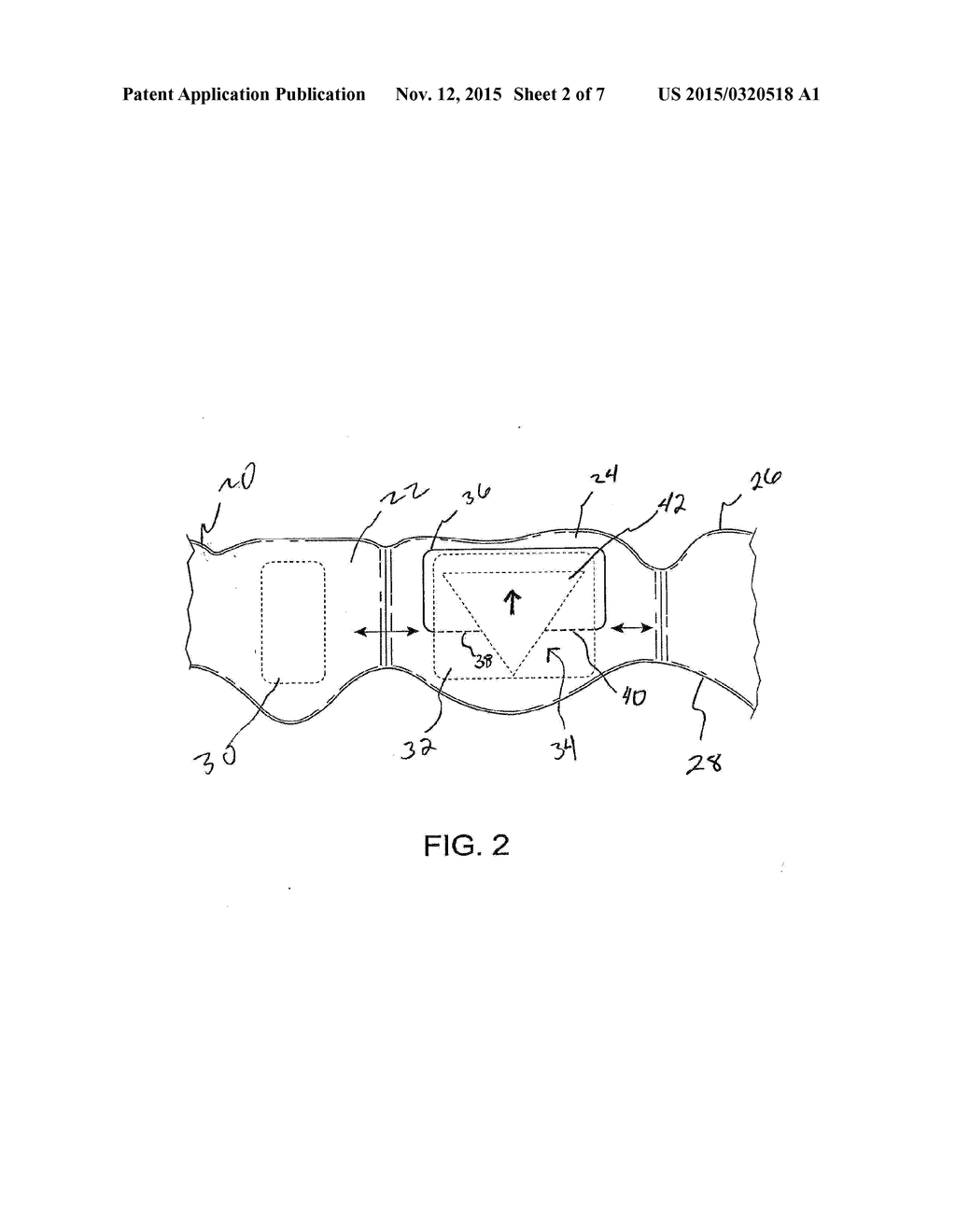 ORTHODONTIC TOOTH MOVEMENT DEVICE, SYSTEMS AND METHODS - diagram, schematic, and image 03