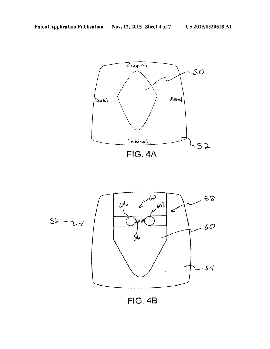 ORTHODONTIC TOOTH MOVEMENT DEVICE, SYSTEMS AND METHODS - diagram, schematic, and image 05