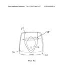 ORTHODONTIC TOOTH MOVEMENT DEVICE, SYSTEMS AND METHODS diagram and image