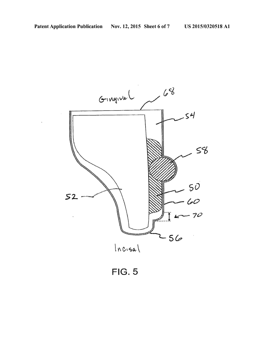 ORTHODONTIC TOOTH MOVEMENT DEVICE, SYSTEMS AND METHODS - diagram, schematic, and image 07