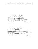 PACKAGING AND TRANSFER SYSTEM FOR AN IMPLANT APPLICATION diagram and image