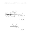 PACKAGING AND TRANSFER SYSTEM FOR AN IMPLANT APPLICATION diagram and image