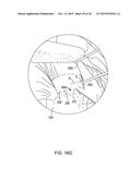 MEDICAL IMPLANT DELIVERY SYSTEM AND RELATED METHODS diagram and image