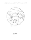 MEDICAL IMPLANT DELIVERY SYSTEM AND RELATED METHODS diagram and image