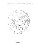 MEDICAL IMPLANT DELIVERY SYSTEM AND RELATED METHODS diagram and image