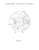 MEDICAL IMPLANT DELIVERY SYSTEM AND RELATED METHODS diagram and image