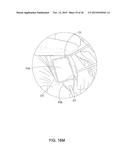 MEDICAL IMPLANT DELIVERY SYSTEM AND RELATED METHODS diagram and image