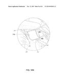 MEDICAL IMPLANT DELIVERY SYSTEM AND RELATED METHODS diagram and image