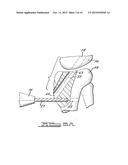 Apparatus And Method For Tibial Fixation Of Soft Tissue diagram and image