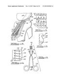 Apparatus And Method For Tibial Fixation Of Soft Tissue diagram and image