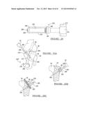 Apparatus And Method For Tibial Fixation Of Soft Tissue diagram and image