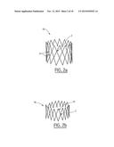 COLLAPSIBLE PROSTHETIC VALVE diagram and image