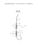 COLLAPSIBLE PROSTHETIC VALVE diagram and image