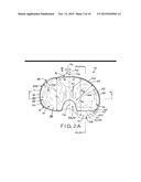 MOTION FACILITATING TIBIAL COMPONENTS FOR A KNEE PROSTHESIS diagram and image