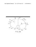 MOTION FACILITATING TIBIAL COMPONENTS FOR A KNEE PROSTHESIS diagram and image