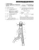 FLEXIBLE STENT GRAFT diagram and image