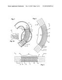 FLEXIBLE STENT GRAFT diagram and image