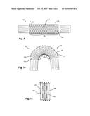 FLEXIBLE STENT GRAFT diagram and image