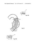 FLEXIBLE STENT GRAFT diagram and image