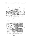 FLEXIBLE STENT GRAFT diagram and image