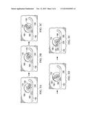 EQUIPMENT AND METHODS USED IN FOLDING AND IMPLANTING FOLDABLE LENSES IN     THE EYE diagram and image