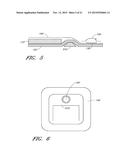 WOUND DRESSING AND METHOD OF USE diagram and image