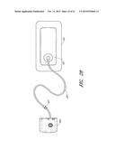 WOUND DRESSING AND METHOD OF USE diagram and image