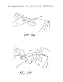 WOUND DRESSING AND METHOD OF USE diagram and image