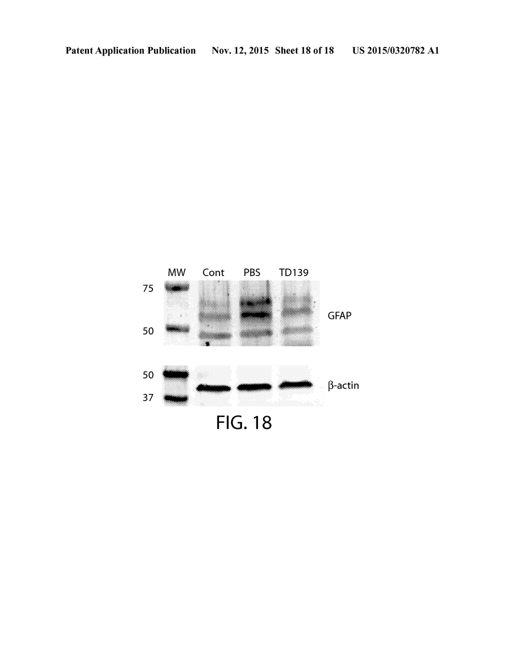 Methods, compositions and kits for treating, modulating, or preventing     ocular angiogenesis or fibrosis in a subject using a galectin protein     inhibitor - diagram, schematic, and image 19