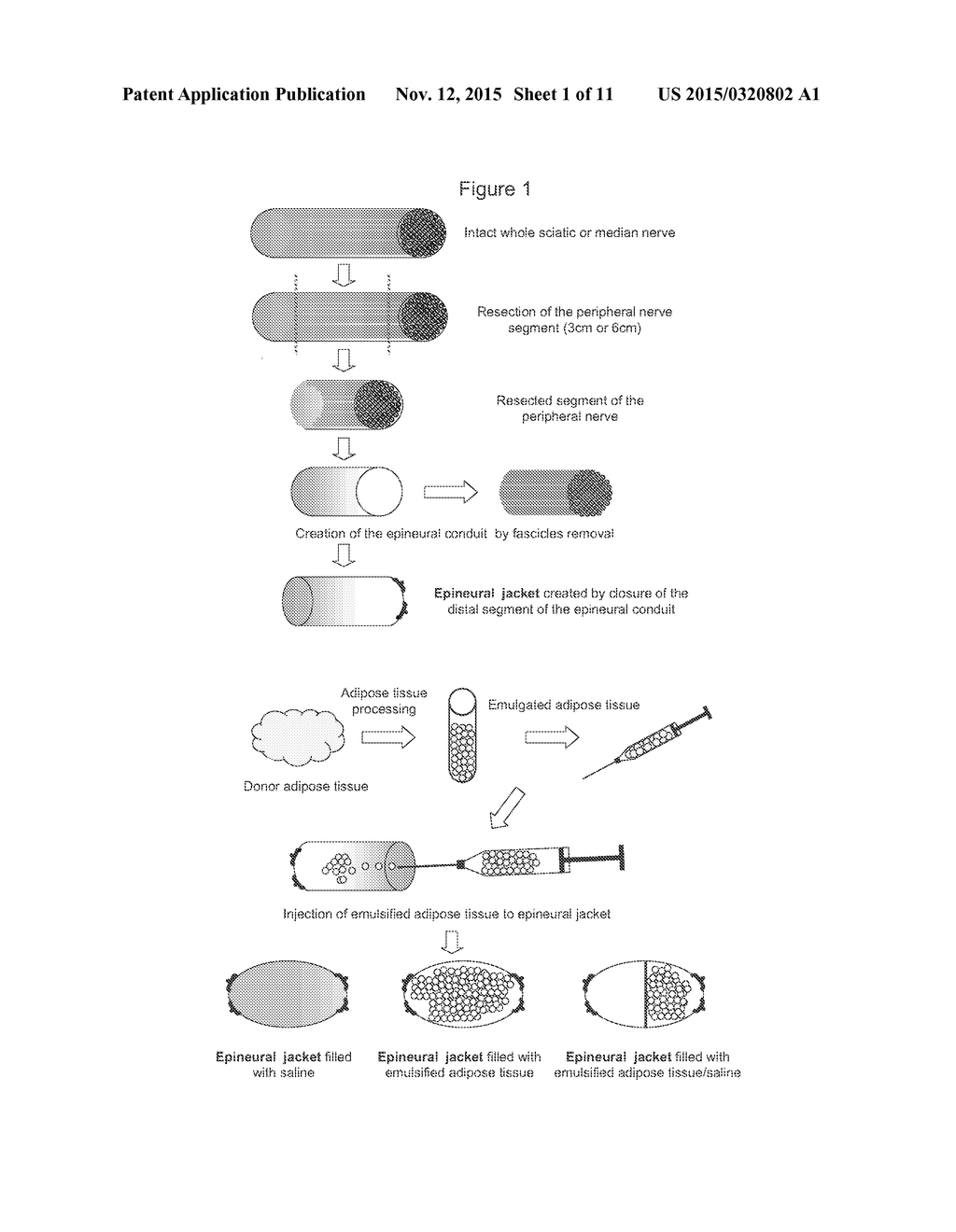 Methods Of Maintaining Fat Volume - diagram, schematic, and image 02