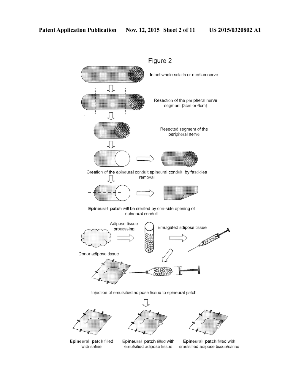 Methods Of Maintaining Fat Volume - diagram, schematic, and image 03