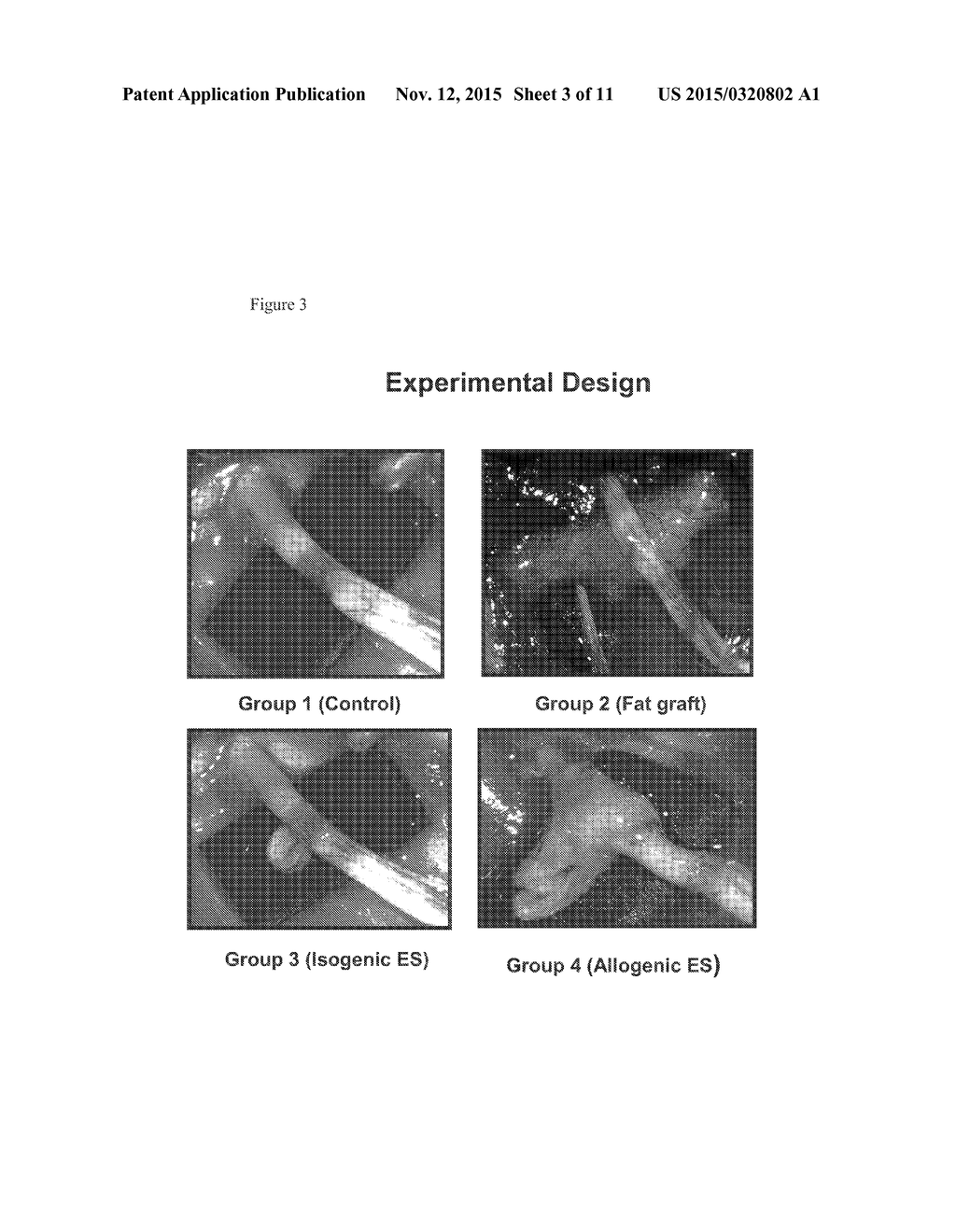 Methods Of Maintaining Fat Volume - diagram, schematic, and image 04