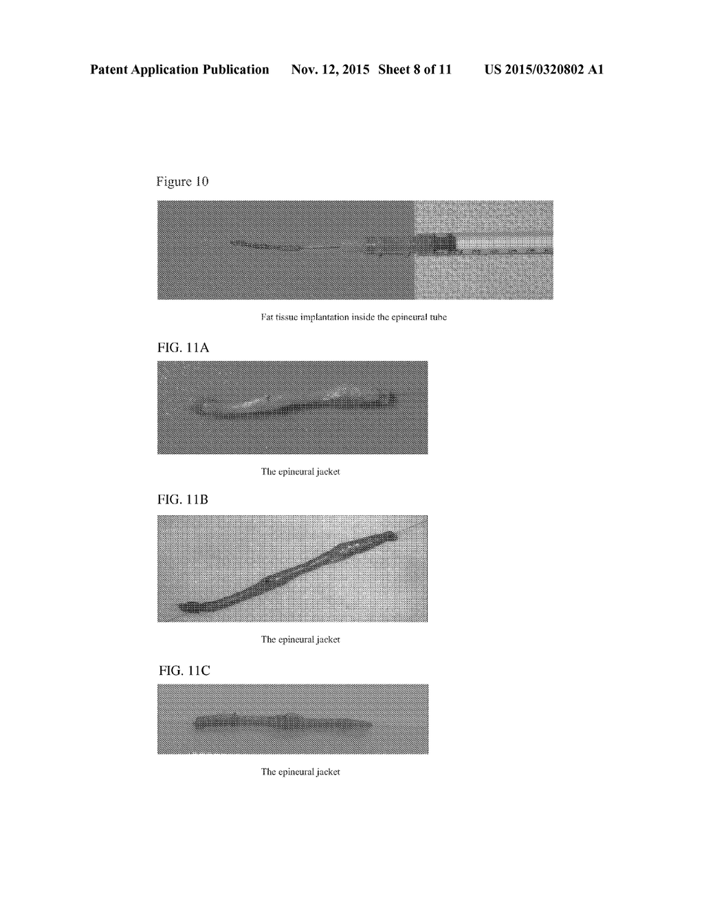 Methods Of Maintaining Fat Volume - diagram, schematic, and image 09