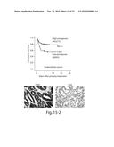 SAPOSIN-A DERIVED PEPTIDES AND USES THEREOF diagram and image