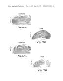 NANOPARTICLES FOR BRAIN TUMOR IMAGING diagram and image