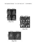 NANOPARTICLES FOR BRAIN TUMOR IMAGING diagram and image