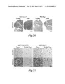 NANOPARTICLES FOR BRAIN TUMOR IMAGING diagram and image