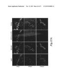 NANOPARTICLES FOR BRAIN TUMOR IMAGING diagram and image